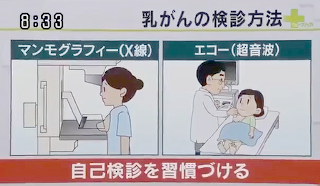 乳がんの検診方法